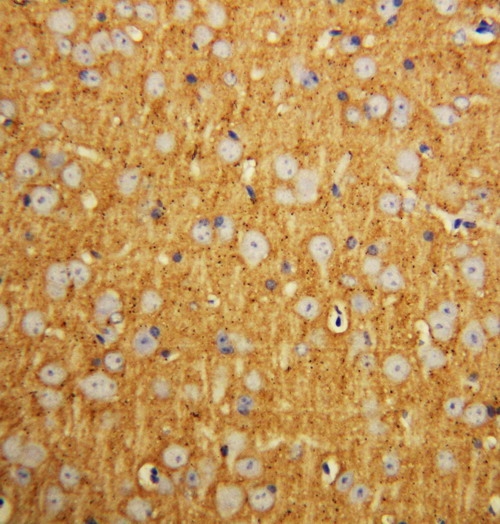 Anti-SNAP25 antibody, PA1315, IHC(P) IHC(P): Rat Brain Tissue