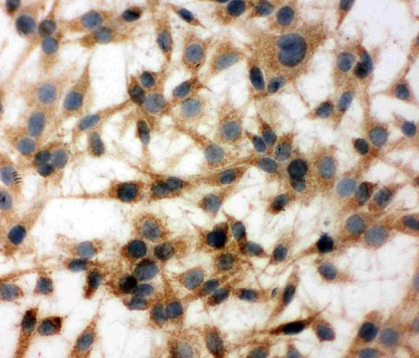 IHC analysis of MTCO1 using anti-MTCO1 antibody (PA1317-1). MTCO1 was detected in immunocytochemical section of C6 Cell. Enzyme antigen retrieval was performed using IHC enzyme antigen retrieval reagent (AR0022) for 15 mins. The cells were blocked with 10% goat serum. And then incubated with 1μg/ml rabbit anti-MTCO1 Antibody (PA1317-1) overnight at 4°C. Biotinylated goat anti-rabbit IgG was used as secondary antibody and incubated for 30 minutes at 37°C. The section was developed using Strepavidin-Biotin-Complex (SABC)(Catalog # SA1022) with DAB as the chromogen.