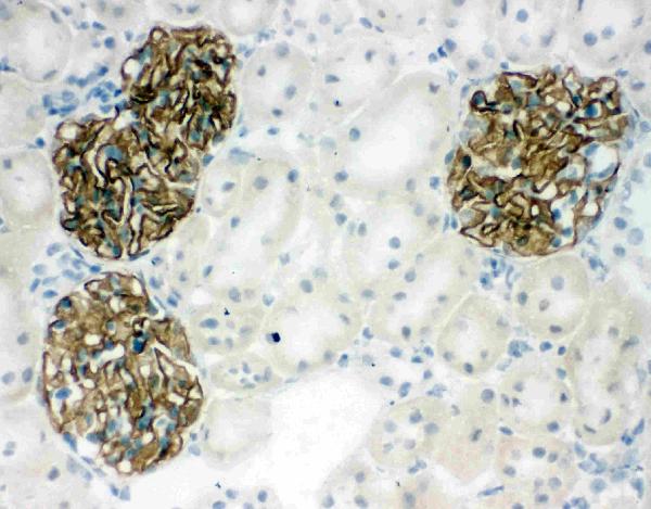 IHC analysis of NPHS2 using anti-NPHS2 antibody (PA1322-1). NPHS2 was detected in frozen section of rat kidney tissues. The tissue section was blocked with 10% goat serum. The tissue section was then incubated with 1μg/ml rabbit anti-NPHS2 Antibody (PA1322-1) overnight at 4°C. Biotinylated goat anti-rabbit IgG was used as secondary antibody and incubated for 30 minutes at 37°C. The tissue section was developed using Strepavidin-Biotin-Complex (SABC)(Catalog # SA1022) with DAB as the chromogen.