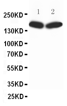 Anti-nNOS(neuronal) antibody, PA1329, Western blotting All lanes: Anti nNOS(neuronal)(PA1329) at 0.5ug/ml Lane 1: Rat Brain Tissue Lysate at 50ug Lane 2: MCF-7 Whole Cell Lysate at 40ug Predicted bind size: 160KD Observed bind size: 160KD