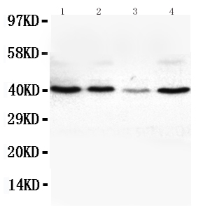 Anti-VEGFD antibody, PA1332, Western blotting Lane 1: SW620 Cell Lysate Lane 2: COLO320 Cell Lysate Lane 3: 6T-CEM Cell Lysate Lane 4: HT1080 Cell Lysate