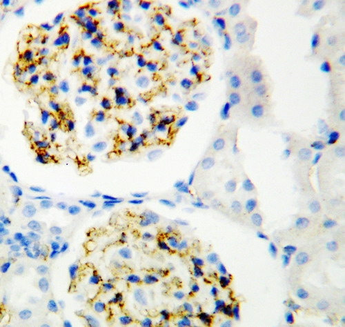 IHC analysis of CD34 using anti-CD34 antibody (PA1334).