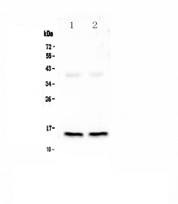 Western blot analysis of Cardiac FABP using anti-Cardiac FABP antibody (PA1336).