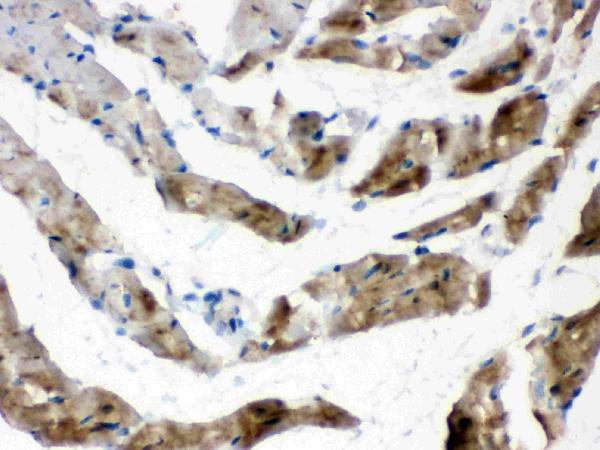 Cardiac FABP was detected in paraffin-embedded sections of rat cardiac muscle tissues using rabbit anti-Cardiac FABP Antigen Affinity purified polyclonal antibody (Catalog # PA1336) at 1 μg/mL. The immunohistochemical section was developed using SABC method (Catalog # SA1022).