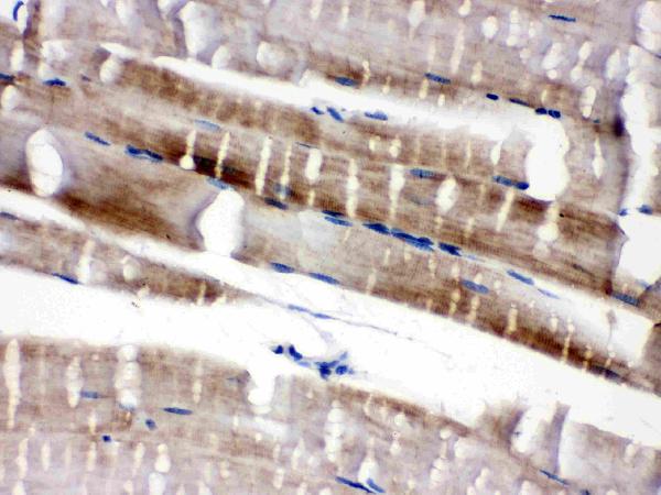 Cardiac FABP was detected in paraffin-embedded sections of mouse skeletal muscletissues using rabbit anti-Cardiac FABP Antigen Affinity purified polyclonal antibody (Catalog # PA1336) at 1 μg/mL. The immunohistochemical section was developed using SABC method (Catalog # SA1022).