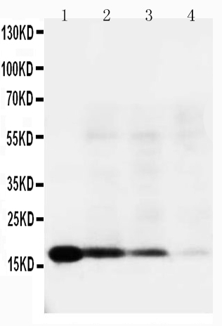 Anti-IL-18 antibody, PA1342, Western blotting Lane 1: Recombinant Human IL-18 Protein 10ng Lane 2: Recombinant Human IL-18 Protein 5ng Lane 3: Recombinant Human IL-18 Protein 2.5ng