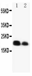 Anti-IL-6 antibody, PA1352, Western blotting Lane 1: Recombinant Mouse IL-4 Protein 10ng Lane 2: Recombinant Mouse IL-4 Protein 5ng