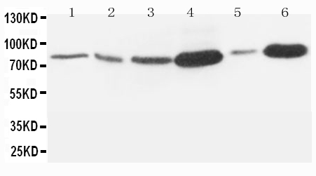 Anti-MMP-9 antibody, PA1357, Western blotting Lane 1: Rat Embryo Tissue Lysate Lane 2: MM453 Cell Lysate Lane 3: HELA Cell Lysate Lane 4: SMMC Cell Lysate Lane 5: JURKAT Cell Lysate Lane 6: HT1080 Cell Lysate