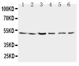 Anti-Presenilin 2 antibody, PA1358, Western blotting Lane 1: Rat Brain Tissue Lysate Lane 2: Rat Brain Tissue Lysate Lane 3: MCF-7 Cell Lysate Lane 4: HELA Cell Lysate Lane 5: SMMC Cell Lysate Lane 6: CEM Cell Lysate