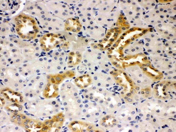 Anti-Presenilin 2 antibody, PA1358, IHC(P) IHC(P): Rat Kidney Tissue