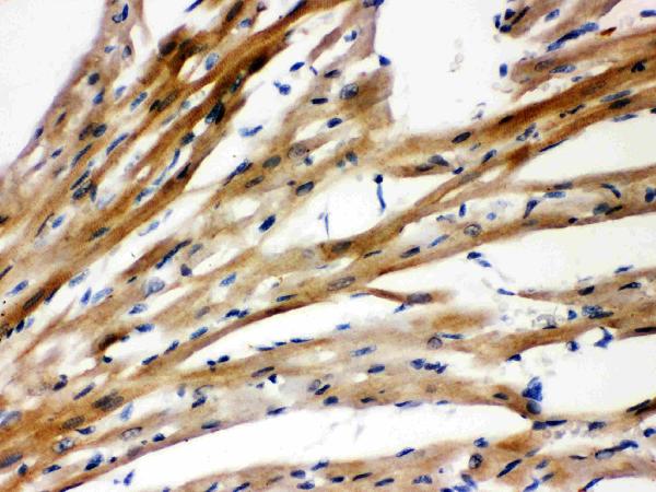 Anti-Presenilin 2 antibody, PA1358, IHC(P) IHC(P): Rat Cardiac Muscle Tissue