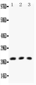 Anti-TNF beta antibody, PA1361-1, All Western blotting All lanes: Anti-TNF beta(PA1361-1) at 0.5ug/ml