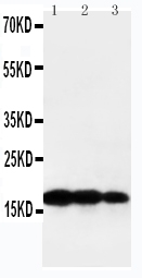 Anti-TNF beta antibody, PA1361, Western blotting Lane 1: Recombinant Human TNF beta Protein 10ng Lane 2: Recombinant Human TNF beta Protein 5ng Lane 3: Recombinant Human TNF beta Protein 2.5ng