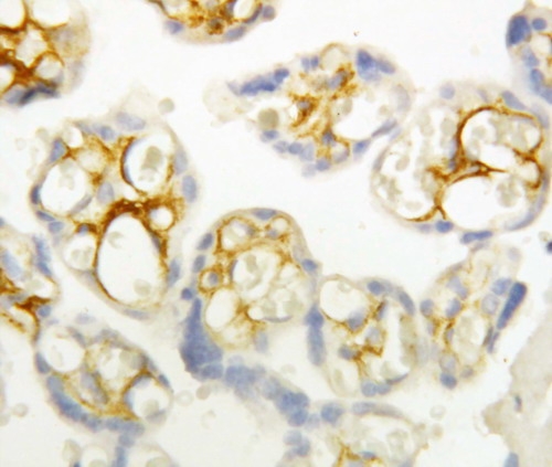 IHC analysis of CDH3 using anti-CDH3 antibody (PA1363). CDH3 was detected in paraffin-embedded section of human placenta tissues. Heat mediated antigen retrieval was performed in citrate buffer (pH6, epitope retrieval solution) for 20 mins. The tissue section was blocked with 10% goat serum. The tissue section was then incubated with 1μg/ml rabbit anti-CDH3 Antibody (PA1363) overnight at 4°C. Biotinylated goat anti-rabbit IgG was used as secondary antibody and incubated for 30 minutes at 37°C. The tissue section was developed using Strepavidin-Biotin-Complex (SABC)(Catalog # SA1022) with DAB as the chromogen.