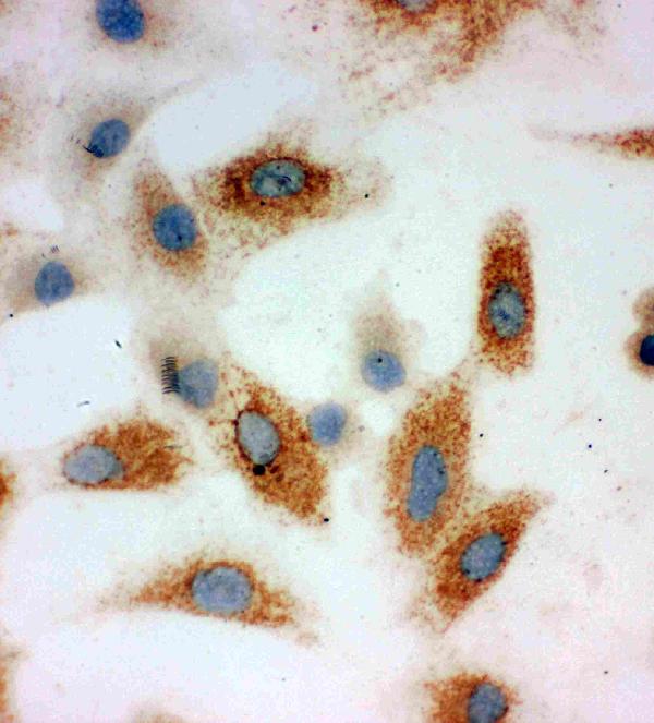 IHC analysis of CDH3 using anti-CDH3 antibody (PA1363). CDH3 was detected in immunocytochemical section of A549 cell. Enzyme antigen retrieval was performed using IHC enzyme antigen retrieval reagent (AR0022) for 15 mins. The cells were blocked with 10% goat serum. And then incubated with 1μg/ml rabbit anti-CDH3 Antibody (PA1363) overnight at 4°C. Biotinylated goat anti-rabbit IgG was used as secondary antibody and incubated for 30 minutes at 37°C. The section was developed using Strepavidin-Biotin-Complex (SABC)(Catalog # SA1022) with DAB as the chromogen.