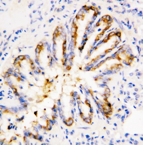 IHC analysis of Calpain 1 using anti-Calpain 1 antibody (PA1364). Calpain 1 was detected in paraffin-embedded section of rat lung tissues. Heat mediated antigen retrieval was performed in citrate buffer (pH6, epitope retrieval solution) for 20 mins. The tissue section was blocked with 10% goat serum. The tissue section was then incubated with 1μg/ml rabbit anti-Calpain 1 Antibody (PA1364) overnight at 4°C. Biotinylated goat anti-rabbit IgG was used as secondary antibody and incubated for 30 minutes at 37°C. The tissue section was developed using Strepavidin-Biotin-Complex (SABC)(Catalog # SA1022) with DAB as the chromogen.