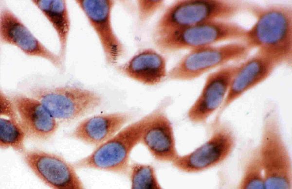 IHC analysis of Calpain 1 using anti-Calpain 1 antibody (PA1364). Calpain 1 was detected in immunocytochemical section of HELA Cell. Enzyme antigen retrieval was performed using IHC enzyme antigen retrieval reagent (AR0022) for 15 mins. The cells were blocked with 10% goat serum. And then incubated with 1μg/ml rabbit anti-Calpain 1 Antibody (PA1364) overnight at 4°C. Biotinylated goat anti-rabbit IgG was used as secondary antibody and incubated for 30 minutes at 37°C. The section was developed using Strepavidin-Biotin-Complex (SABC)(Catalog # SA1022) with DAB as the chromogen.