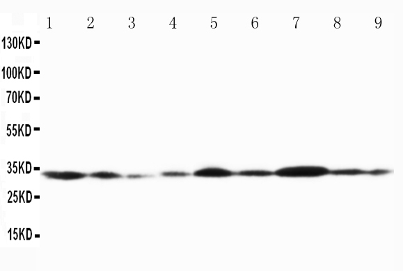 Anti-Connexin 32/GJB1 antibody, PA1367, Western blotting Lane 1: Rat Cardiac Muscle Tissue Lysate Lane 2: Rat Cardiac Muscle Tissue Lysate Lane 3: Rat Skeletal Muscle Tissue Lysate Lane 4: Rat Brain Tissue Lysate Lane 5: MCF-7 Cell Lysate Lane 6: HELA Cell Lysate