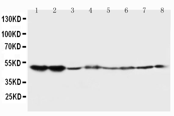 Anti-5HT2A Receptor antibody, PA1373, Western blotting Lane 1: Rat Brain Tissue Lysate Lane 2: Rat Brain Tissue Lysate Lane 3: Mouse Brain Tissue Lysate Lane 4: Mouse Brain Tissue Lysate Lane 5: U87 Cell Lysate Lane 6: SMMC Cell Lysate Lane 7: HT1080 Cell Lysate