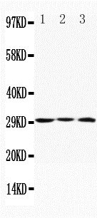 Anti-Apolipoprotein D antibody, PA1388, Western blotting Lane 1: MCF-7 Cell Lysate Lane 2: HELA Cell Lysate Lane 3: SMMC Cell Lysate