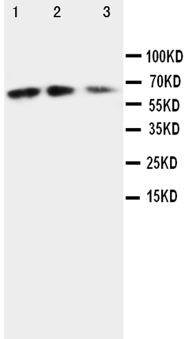 Anti-CX3CL1 antibody, PA1401, Western blotting Lane 1: Recombinant Mouse Fractalkin Protein 10ng Lane 2: Recombinant Mouse Fractalkin Protein 5ng Lane 3: Recombinant Mouse Fractalkin Protein 2.5ng