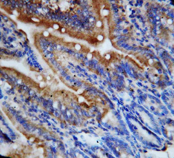 Anti-CX3CL1 antibody, PA1401, IHC(P) IHC(P): Rat Intestine Tissue