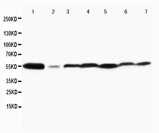 Anti-MAPK8/9 antibody, PA1407, Western blotting Lane 1: Rat Brain Tissue Lysate Lane 2: Rat Thymus Tissue Lysate Lane 3: MCF-7 Cell Lysate Lane 4: HELA Cell Lysate Lane 5: JURKAT Cell Lysate Lane 6: MM231 Cell Lysate Lane 7: CEM Cell Lysate