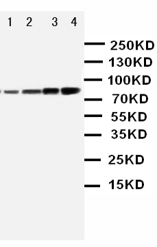 Anti-PI 3 Kinase p85 alpha antibody, PA1410, Western blotting Lane 1: MCF-7 Cell Lysate Lane 2: HELA Cell Lysate Lane 3: COLO-320 whole cell lysate Lane 4: SW620 Cell Lysate