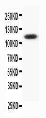 Anti-Progesterone Receptor antibody, PA1413, Western blotting WB: HELA Cell Lysate