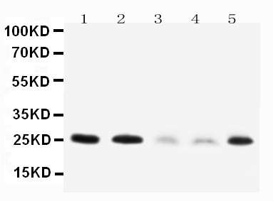 Anti-Pleiotrophin antibody, PA1414, Western blotting Lane 1: Rat Brain Tissue Lysate Lane 2: Rat Kidney Tissue Lysate Lane 3: MCF-7 Cell Lysate Lane 4: HT1080 Cell Lysate Lane 5: SMMC Cell Lysate