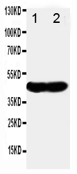 Anti-NDRG1 antibody, PA1416, Western blotting Lane 1: SMMC Nucleus Cell Lysate Lane 2: SMMC Cytoplasm Cell Lysate