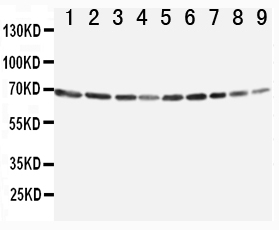 Anti-Annexin VI antibody, PA1436, Western blotting Lane 1: Rat Ovary Tissue Lysate Lane 2: Rat Liver Tissue Lysate Lane 3: Rat Intestinum Tenue Tissue Lysate Lane 4: Rat Brain Tissue Lysate Lane 5: A549 Cell Lysate Lane 6: JURKAT Cell Lysate