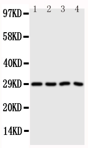 Anti-CA3 antibody, PA1439, Western blotting Lane 1: SMMC Cell Lysate Lane 2: HELA Cell Lysate Lane 3: SW620 Cell Lysate Lane 4: SCG Cell Lysate