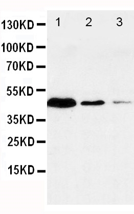 Anti-Caspase-1(P20) antibody, PA1440, Western blotting Lane 1: JURKAT Cell Lysate Lane 2: RAJI Cell Lysate Lane 3: CEM Cell Lysate