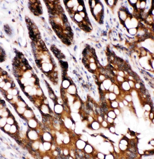 Anti-Caspase-6(P18) antibody, PA1441-1, IHC(P) IHC(P): Rat Intestine Tissue