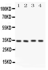 Anti-Caspase-7(P11) antibody, PA1442, Western blotting All lanes: Anti CASP7(p11) (PA1442) at 0.5ug/ml Lane 1: HELA Whole Cell Lysate at 40ug Lane 2: MCF-7 Whole Cell Lysate at 40ug Lane 3: Rat Liver Tissue Lysate at 50ug Lane 4: Rat Kidney Tissue Lysate at 50ug Predicted bind size: 34KD Observed bind size: 34KD