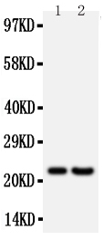 Anti-FGF9 antibody, PA1453, Western blotting All lanes: Anti FGF9 (PA1453) at 0.5ug/ml Lane 1: Rat Brain Tissue Lysate at 50ug Lane 2: HELA Whole Cell Lysate at 40ug Predicted bind size: 23KD Observed bind size: 23KD