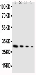 Anti-GDNF antibody, PA1465, Western blotting Lane 1: Recombinant Human GDNF Protein 10ng Lane 2: Recombinant Human GDNF Protein 5ng Lane 3: Recombinant Human GDNF Protein 2.5ng Lane 4: Recombinant Human GDNF Protein 1.25ng