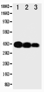 Anti-IL-12(p40) antibody, PA1468, Western blotting Lane 1: Recombinant Human IL-12 Protein 10ng Lane 2: Recombinant Human IL-12 Protein 5ng Lane 3: Recombinant Human IL-12 Protein 2.5ng