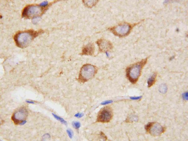 IHC analysis of PPID using anti-PPID antibody (PA1472).