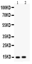 Anti-Fatty Acid Binding Protein 5 antibody, PA1475, Western blotting All lanes: Anti Fatty Acid Binding Protein 5 (PA1475) at 0.5ug/ml Lane 1: HELA Whole Cell Lysate at 40ug Lane 2: HEPG2 Whole Cell Lysate at 40ug Predicted bind size: 15KD Observed bind size: 15KD