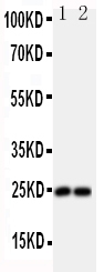 Anti-FGF19 antibody, PA1476, Western blotting All lanes: Anti FGF19 (PA1476) at 0.5ug/ml Lane 1: U87 Whole Cell Lysate at 40ug Lane 2: SMMC Whole Cell Lysate at 40ug Predicted bind size: 24KD Observed bind size: 24KD