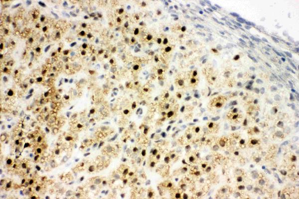 Anti-MTA1 antibody, PA1483, IHC(F) IHC(F): Rat Ovary Tissue