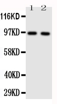 Anti-TLR4 antibody, PA1484, Western blotting Lane 1: HELA Cell Lysate Lane 2: SMMC Cell Lysate