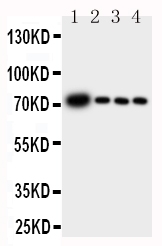 Anti-GCLC antibody, PA1492, Western blotting Lane 1: Rat Brain Tissue Lysate Lane 2: Rat Kidney Tissue Lysate Lane 3: Rat Heart Tissue Lysate Lane 4: Rat Lung Tissue Lysate