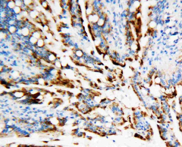 IHC analysis of APEX1 using anti-APEX1 antibody (PA1494).