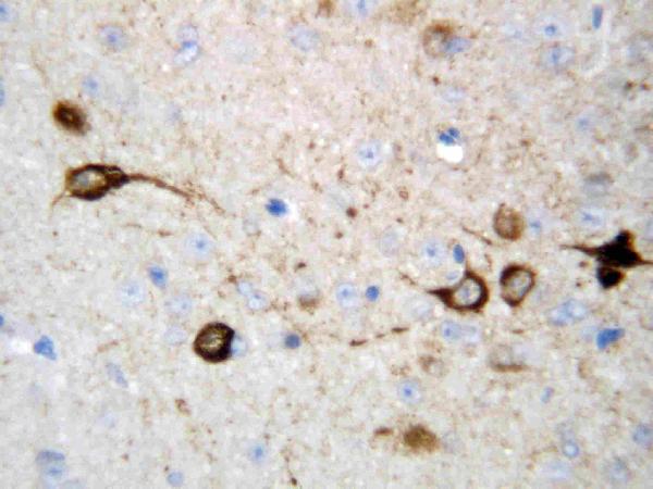 Anti-CAMKK2 antibody, PA1497, IHC(P) IHC(P): Rat Brain Tissue