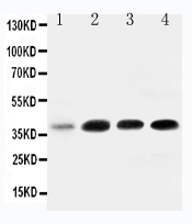 Anti-IGFBP-3 antibody, PA1498, Western blotting All lanes: Anti IGFBP-3 (PA1498) at 0.5ug/ml Lane 1: 293T Whole Cell Lysate at 40ug Lane 2: MCF-7 Whole Cell Lysate at 40ug Lane 3: A549 Whole Cell Lysate at 40ug Lane 4: SW620 Whole Cell Lysate at 40ug Predicted bind size: 32KD Observed bind size: 40KD