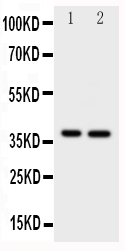 Anti-MCL1 antibody, PA1503, Western blotting All lanes: Anti MCL1 (PA1503) at 0.5ug/ml