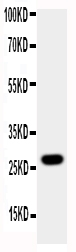 Western blot analysis of AQP8 using anti-AQP8 antibody (PA1511). Electrophoresis was performed on a 5-20% SDS-PAGE gel at 70V (Stacking gel) / 90V (Resolving gel) for 2-3 hours. The sample well of each lane was loaded with 50ug of sample under reducing conditions. Lane 1: human A431 whole cell lysates. After Electrophoresis, proteins were transferred to a Nitrocellulose membrane at 150mA for 50-90 minutes. Blocked the membrane with 5% Non-fat Milk/ TBS for 1.5 hour at RT. The membrane was incubated with rabbit anti-AQP8 antigen affinity purified polyclonal antibody (Catalog # PA1511) at 0.5 μg/mL overnight at 4°C, then washed with TBS-0.1%Tween 3 times with 5 minutes each and probed with a goat anti-rabbit IgG-HRP secondary antibody at a dilution of 1:10000 for 1.5 hour at RT. The signal is developed using an Enhanced Chemiluminescent detection (ECL) kit (Catalog # EK1002) with Tanon 5200 system. A specific band was detected for AQP8 at approximately 27KD. The expected band size for AQP8 is at 27KD.